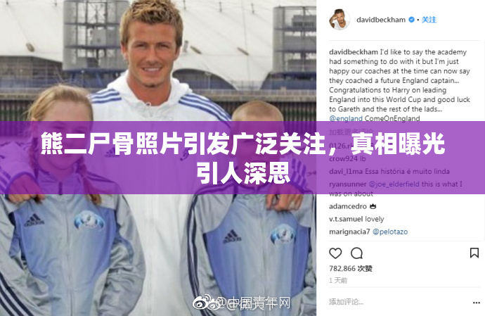 熊二尸骨照片引发广泛关注，真相曝光引人深思