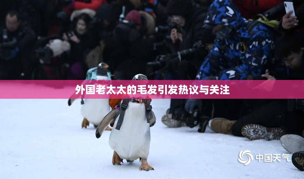 外国老太太的毛发引发热议与关注