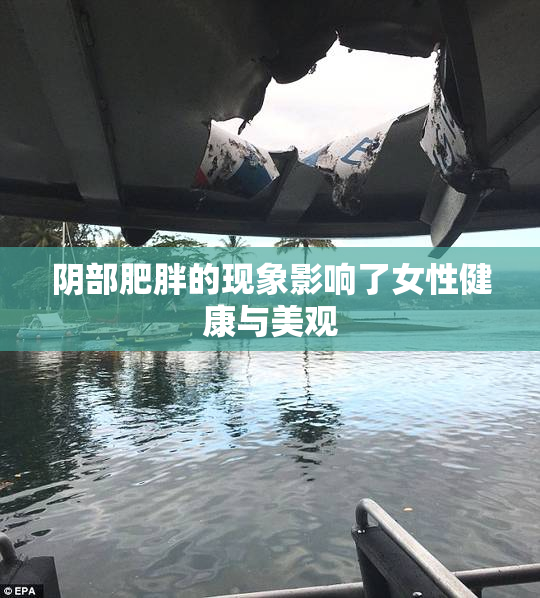 阴部肥胖的现象影响了女性健康与美观