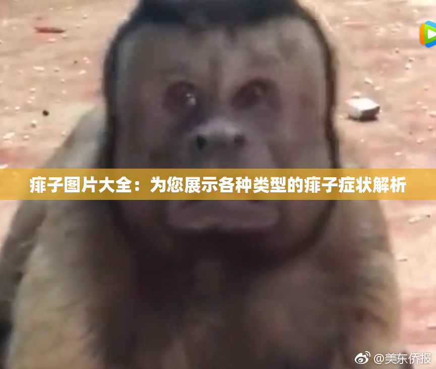痱子图片大全：为您展示各种类型的痱子症状解析