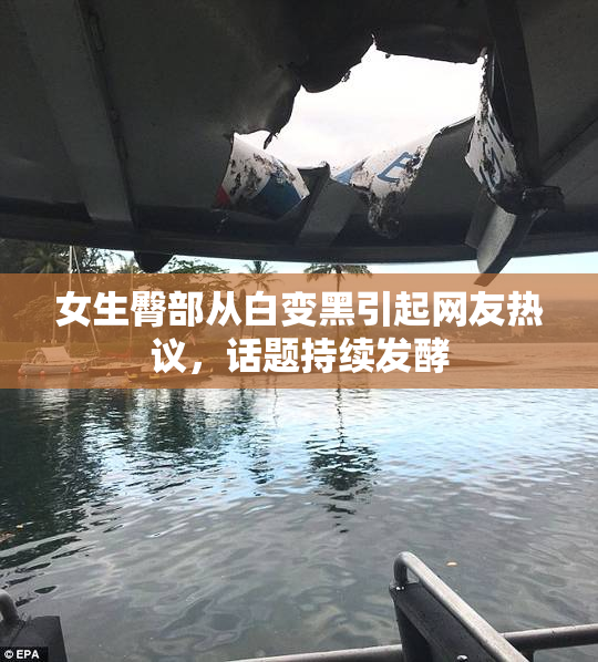 女生臀部从白变黑引起网友热议，话题持续发酵