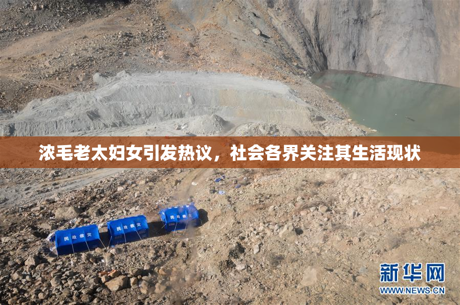浓毛老太妇女引发热议，社会各界关注其生活现状
