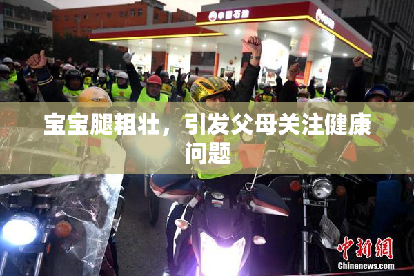 宝宝腿粗壮，引发父母关注健康问题