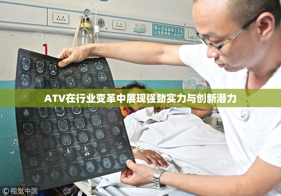 ATV在行业变革中展现强劲实力与创新潜力