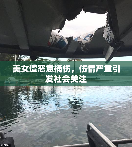美女遭恶意捅伤，伤情严重引发社会关注
