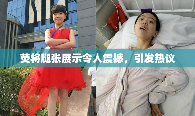 荧将腿张展示令人震撼，引发热议