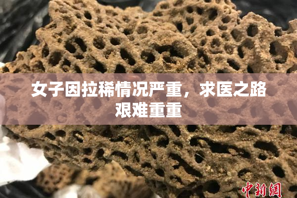 女子因拉稀情况严重，求医之路艰难重重