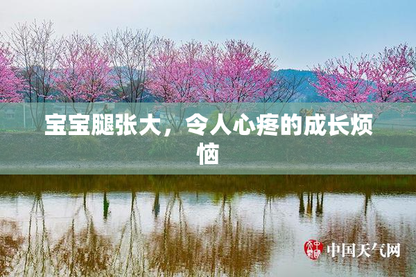 宝宝腿张大，令人心疼的成长烦恼