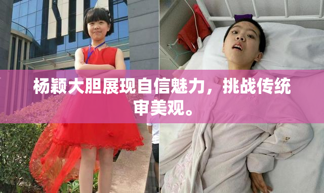 杨颖大胆展现自信魅力，挑战传统审美观。