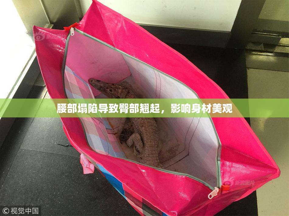 腰部塌陷导致臀部翘起，影响身材美观