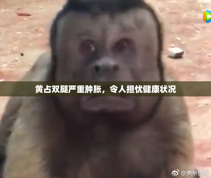 黄占双腿严重肿胀，令人担忧健康状况