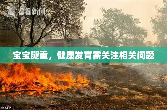 宝宝腿重，健康发育需关注相关问题