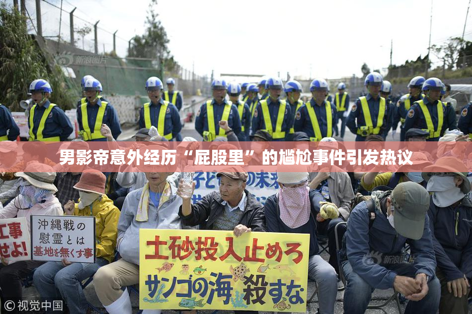 男影帝意外经历“屁股里”的尴尬事件引发热议