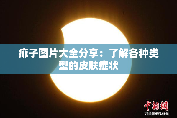 痱子图片大全分享：了解各种类型的皮肤症状